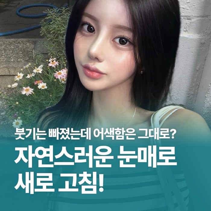 자연스러운 눈매교정 재수술